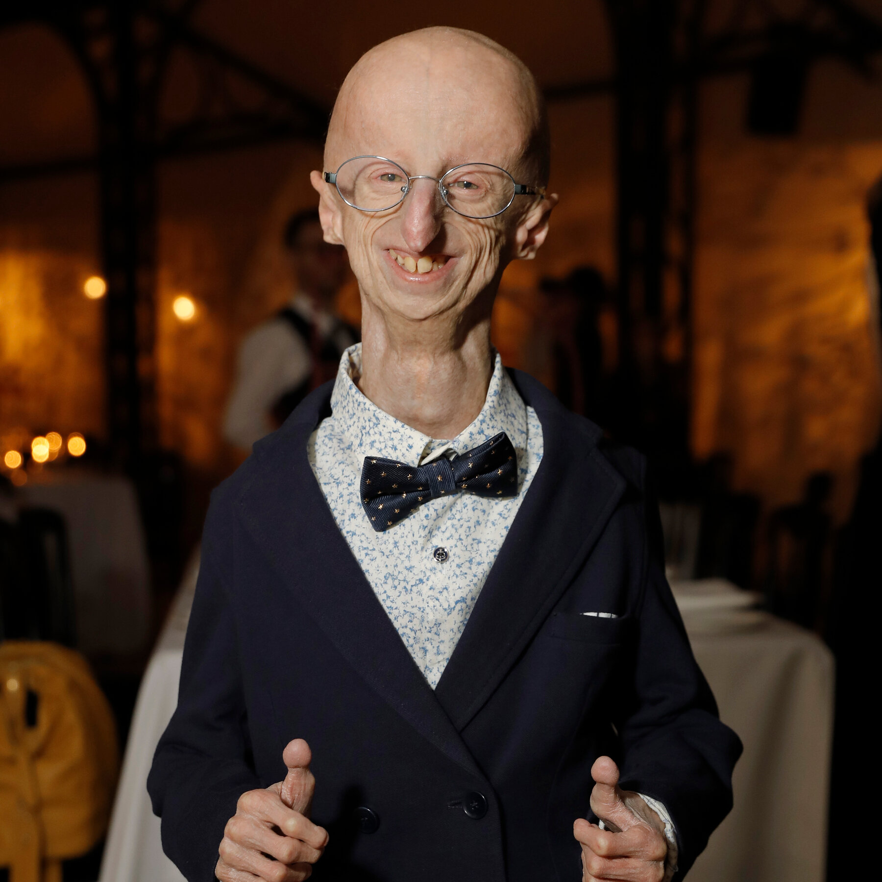 Sammy Basso, Advocate for Progeria Research, Is Dead at 28